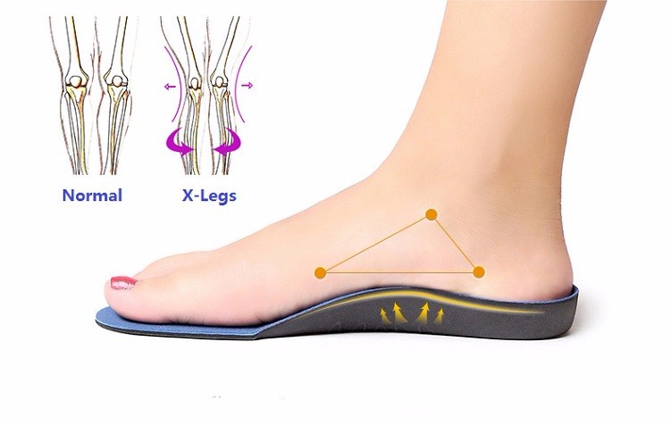 come4buy.com-Flat Feet Arch Support Insoles Orthopedic
