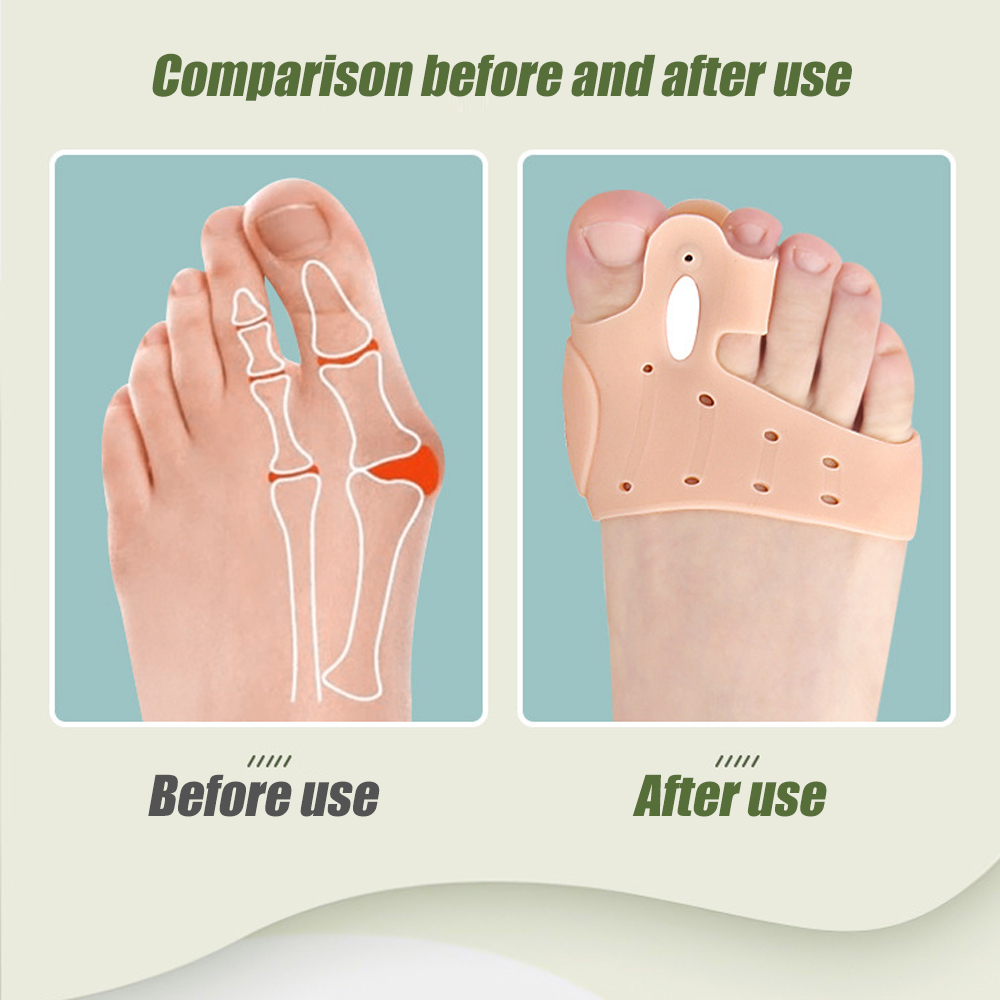 Come4Buy-eShop com4buy.com-Miếng dán lõi silicon ở bàn chân trước Giảm đau và viêm